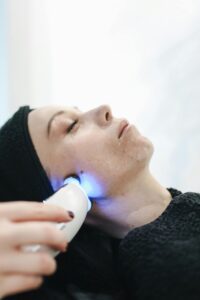 chemical peel